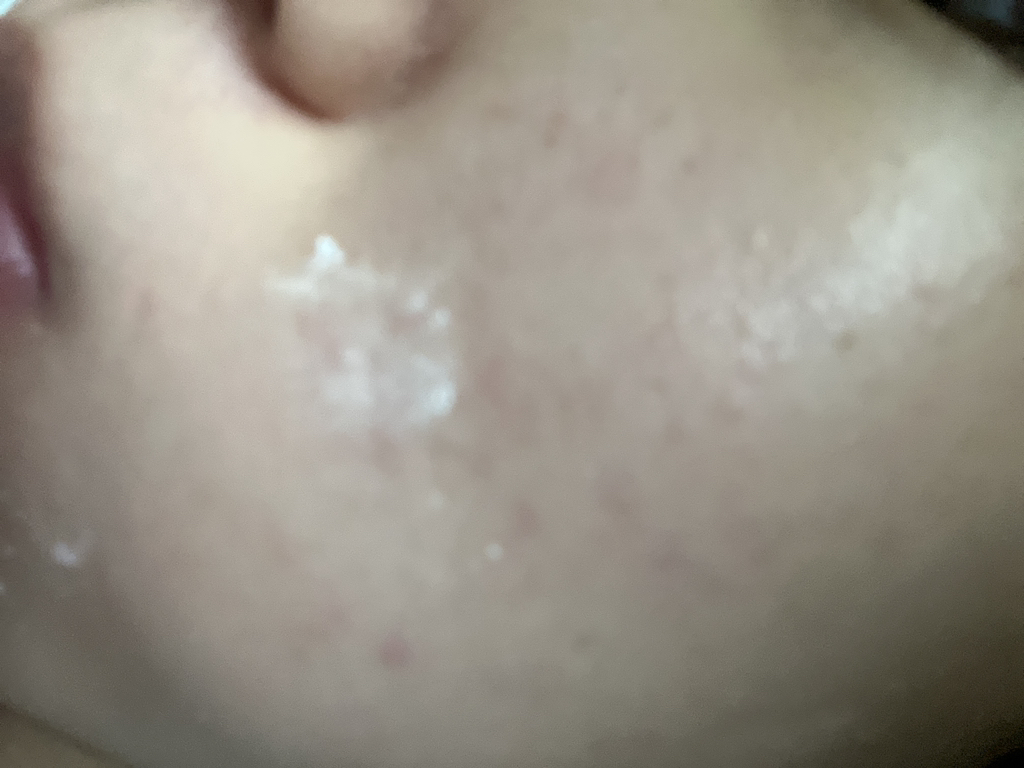 薄荷叶毛孔修护精华的真实用户使用照片