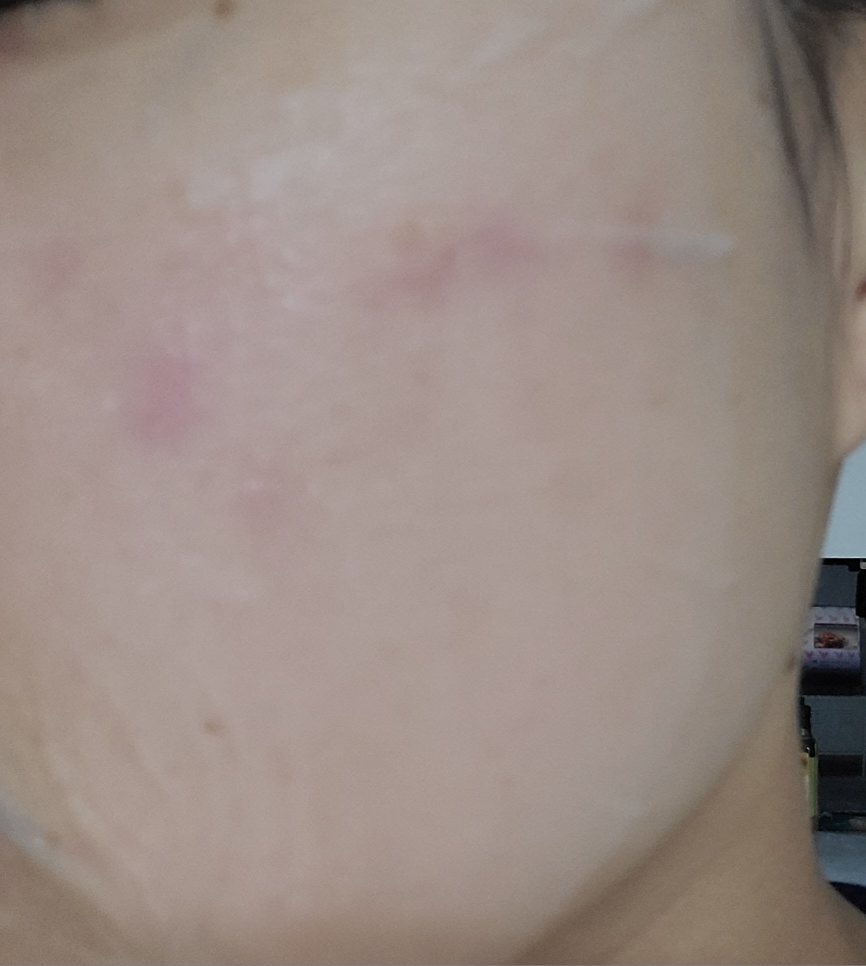 舒缓保湿轻质面膜的真实用户使用照片