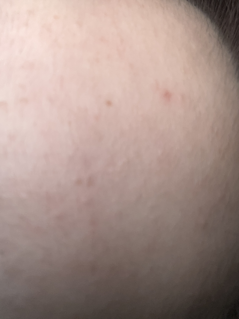 Dr.G 红色痘痕平衡精华液 common.review image