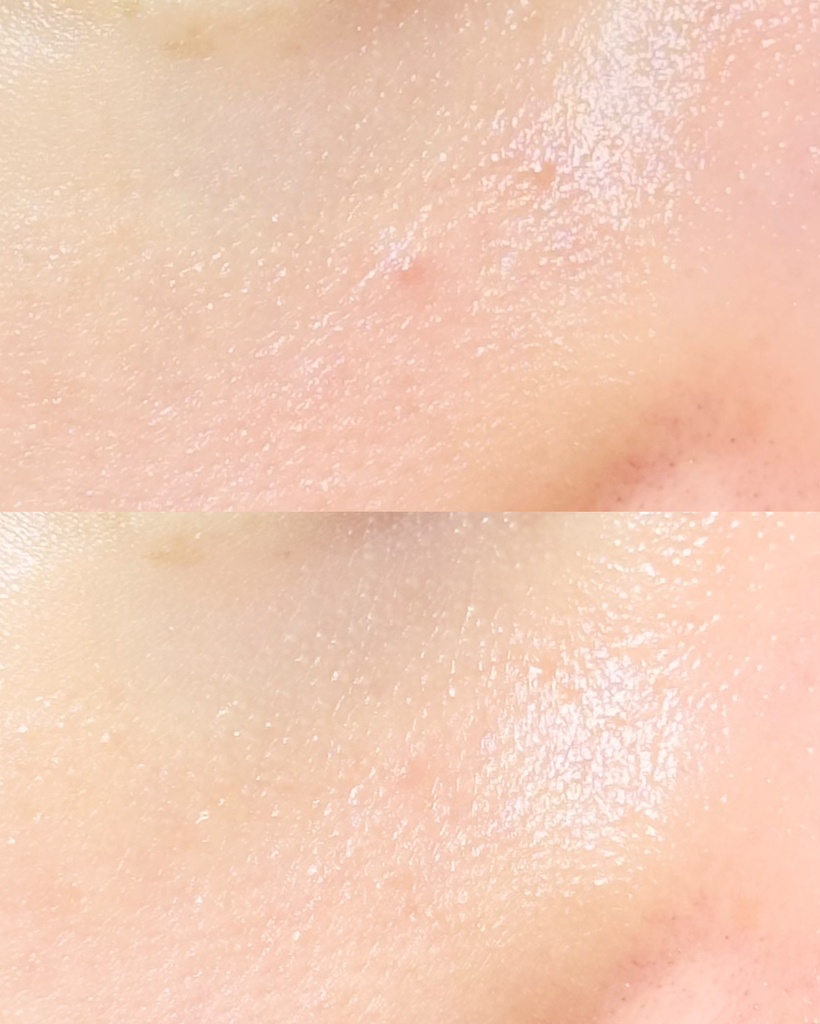 아로셀 (AROCELL) 시카 리페어 판테놀 마스크 review image