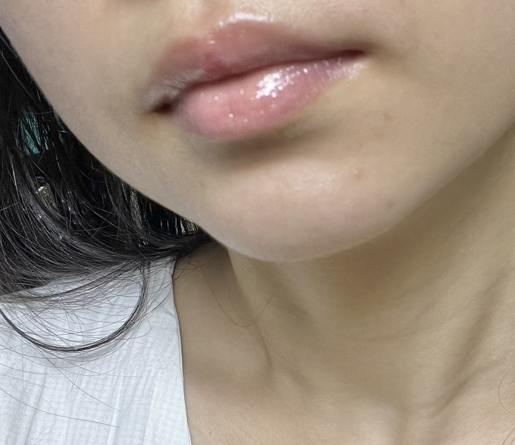 메디포포 (MEDIPAWPAW) 레미디얼 크림 review image