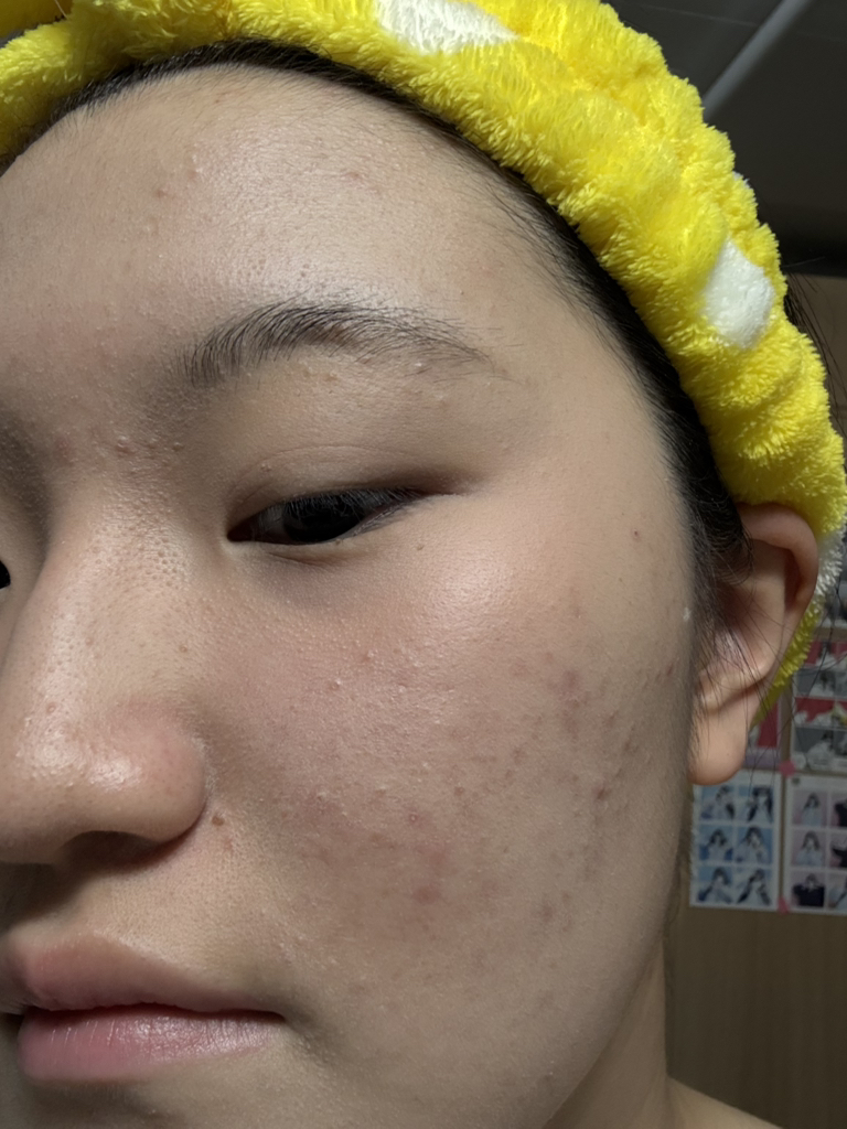 柔恩莱 1025 独岛洁面乳 common.review image