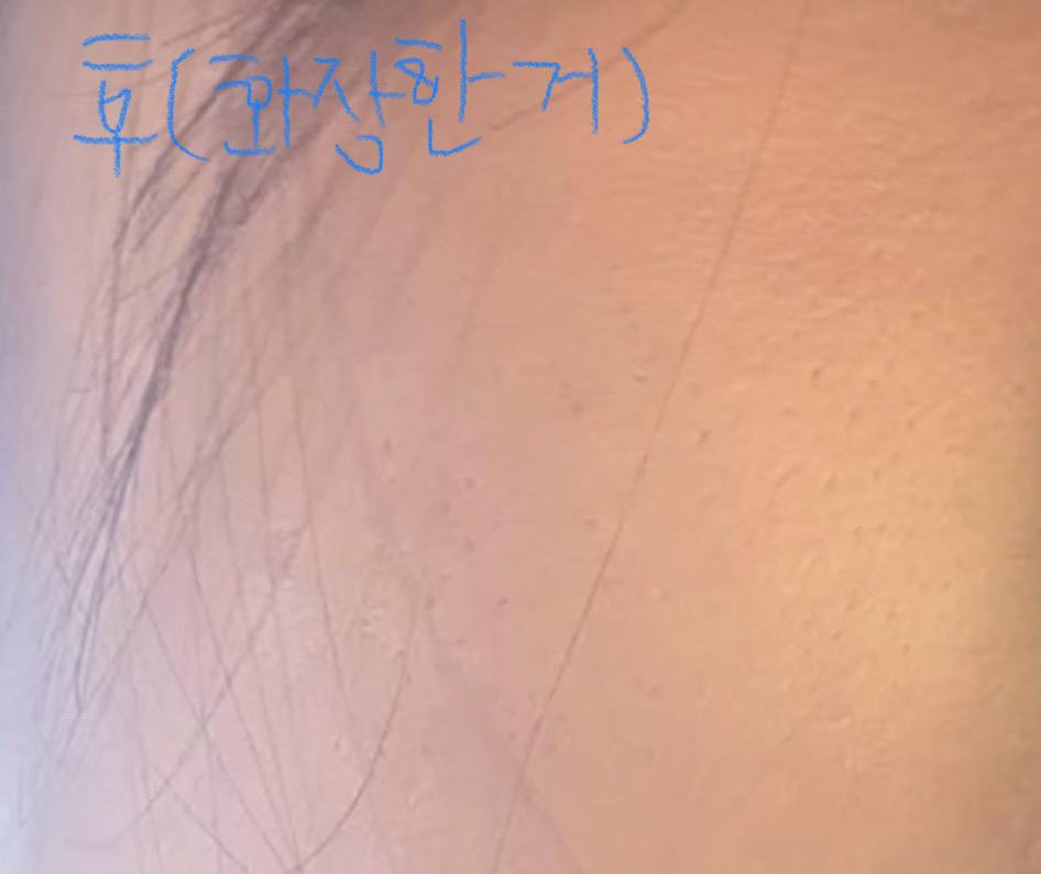 에스트라 (AESTURA) 아토베리어 로션 review image