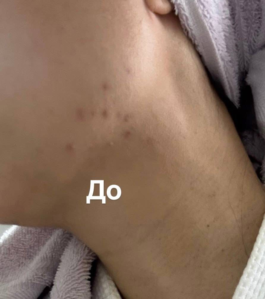 亮白精华的真实用户使用照片
