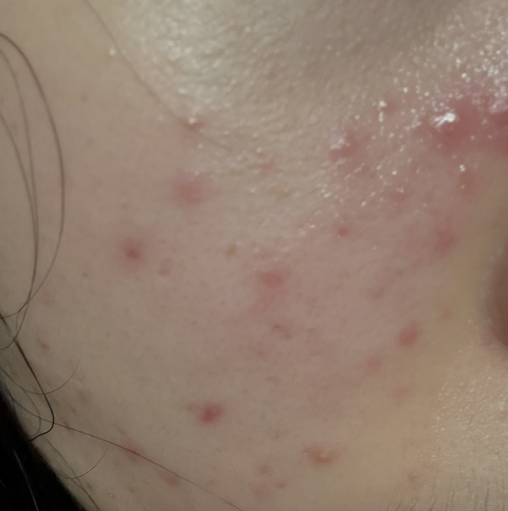 1 款温和洁肤油的真实用户使用照片