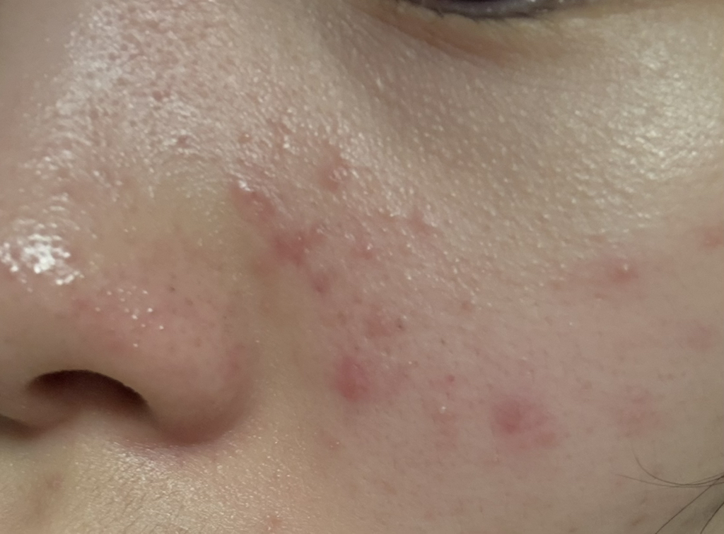 1 款温和洁肤油的真实用户使用照片