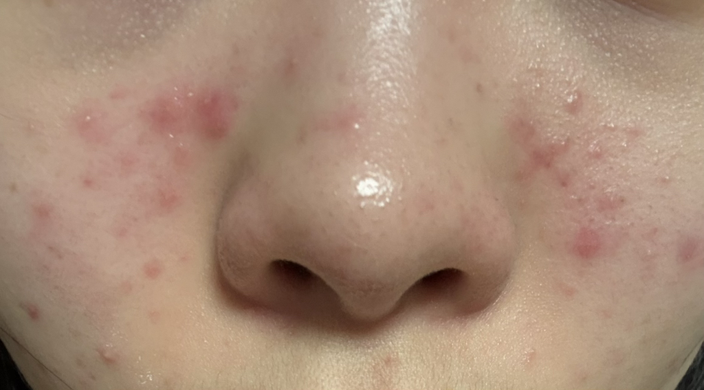 1 款温和洁肤油的真实用户使用照片