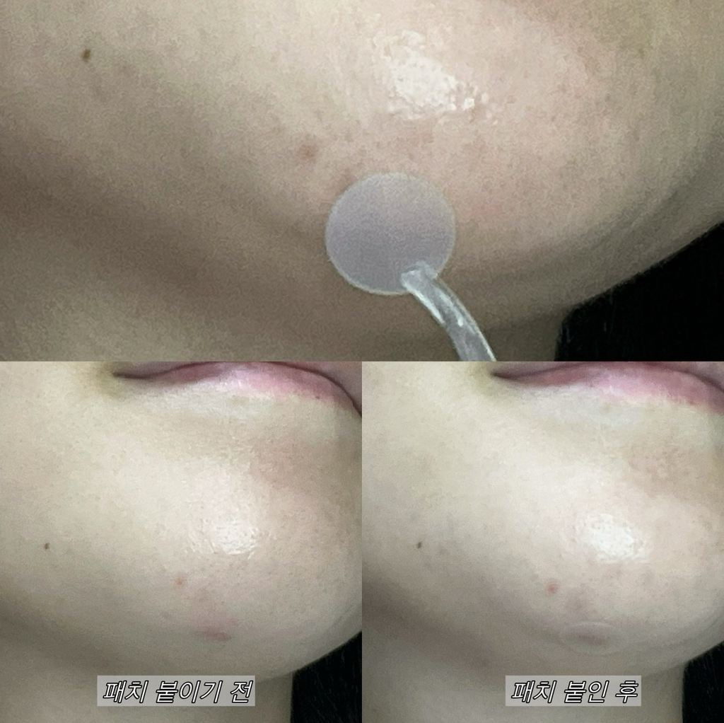 신스루 (sinsuru) 바하 아이코닉 스팟 패치 review image