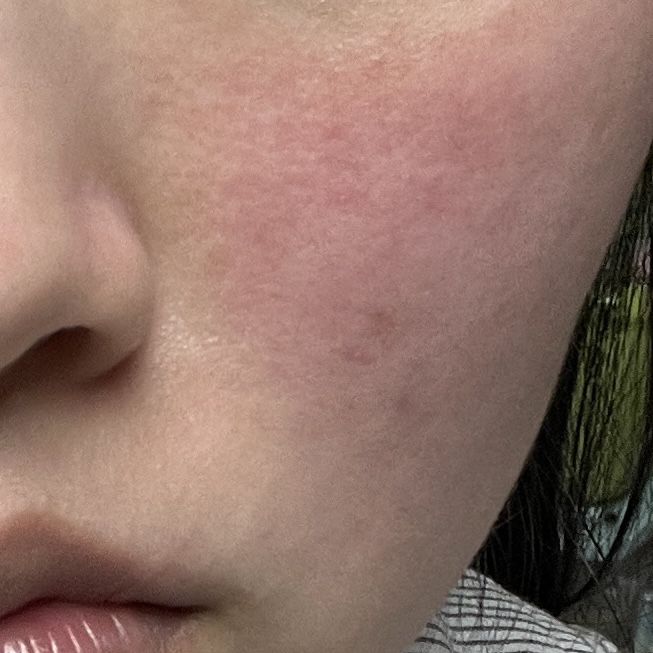 西卡比奥乳霜+的真实用户使用照片
