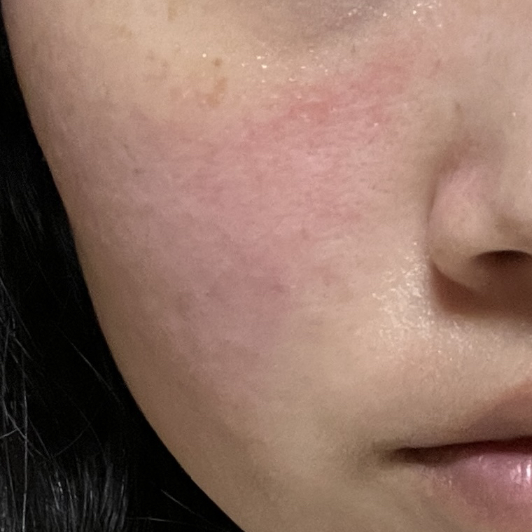 西卡比奥乳霜+的真实用户使用照片