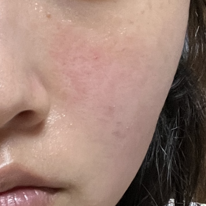 西卡比奥乳霜+的真实用户使用照片