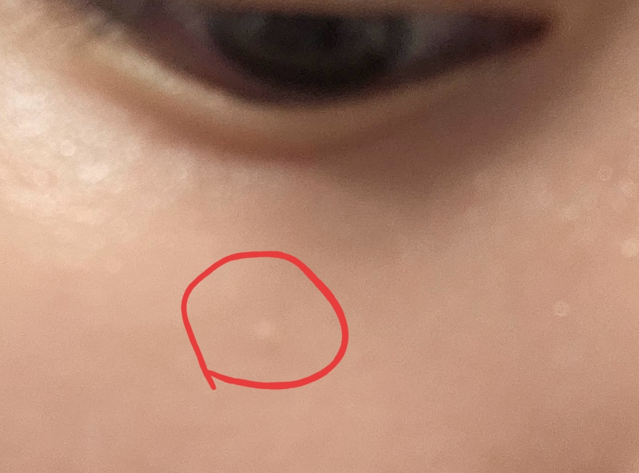 修复疗法润肤霜的真实用户使用照片