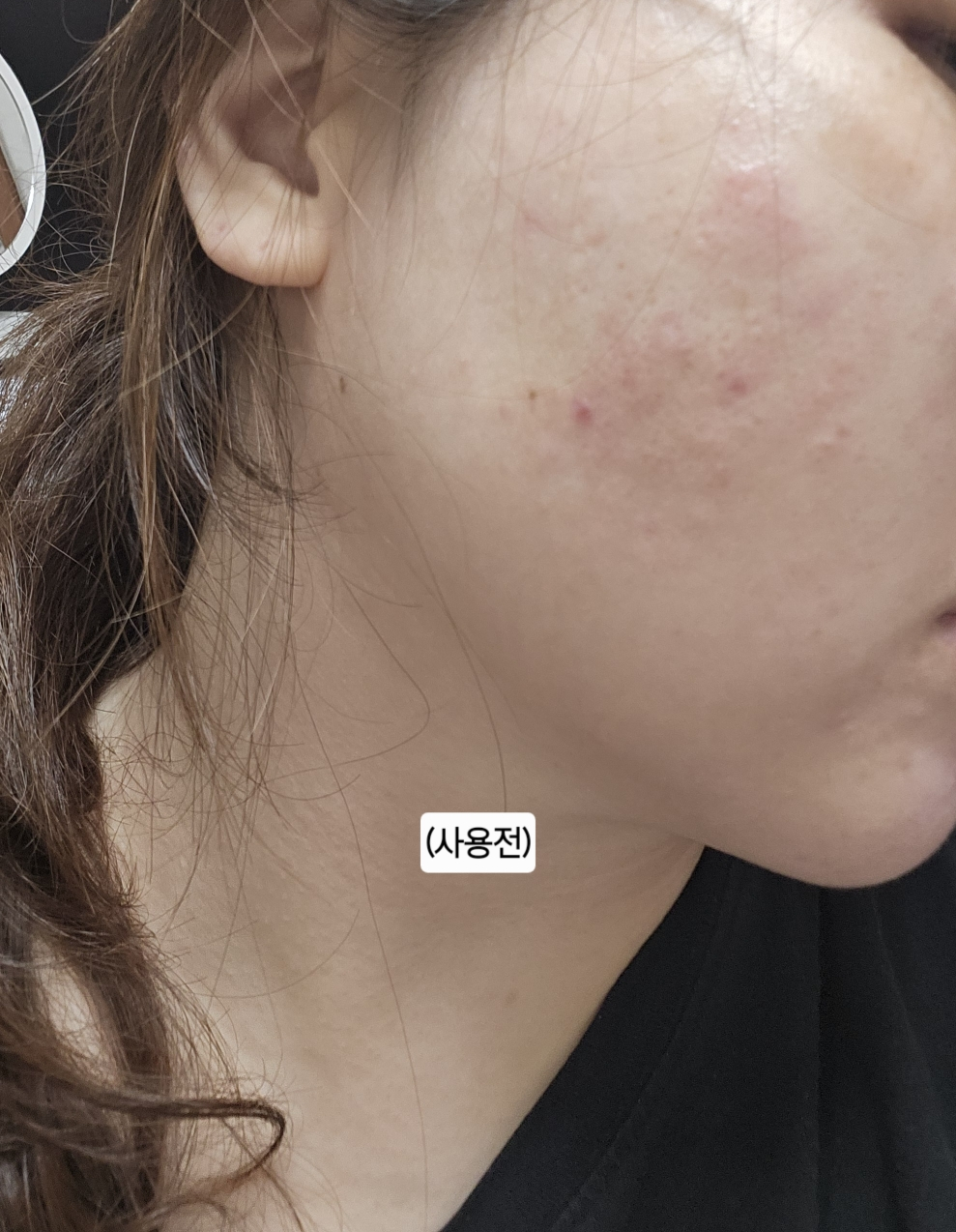 린제이 (LINDSAY) 엄청 큰 멀티 앰플 [영양] review image