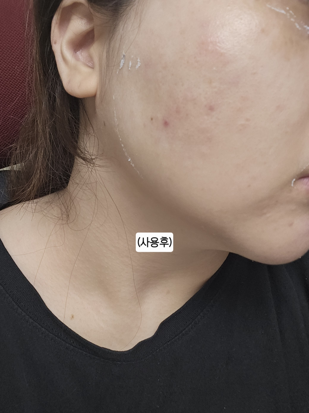린제이 (LINDSAY) 엄청 큰 멀티 앰플 [영양] review image