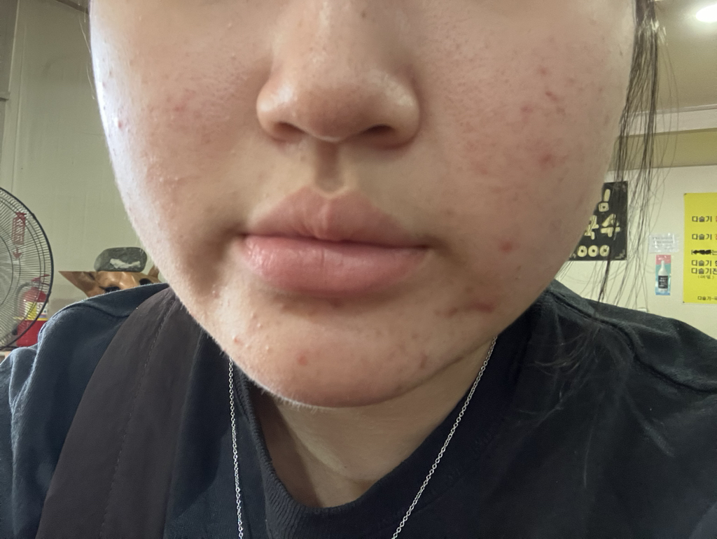 爱普丽至 粉红芦荟粘蛋白精华液 review image