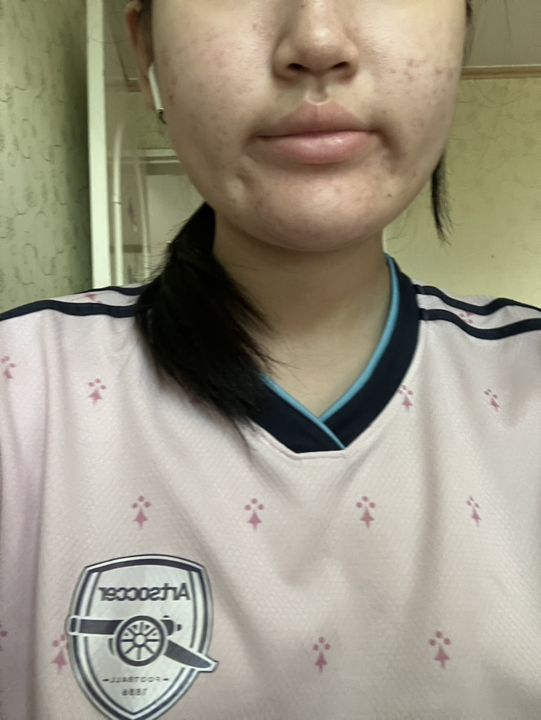 爱普丽至 粉红芦荟粘蛋白精华液 review image