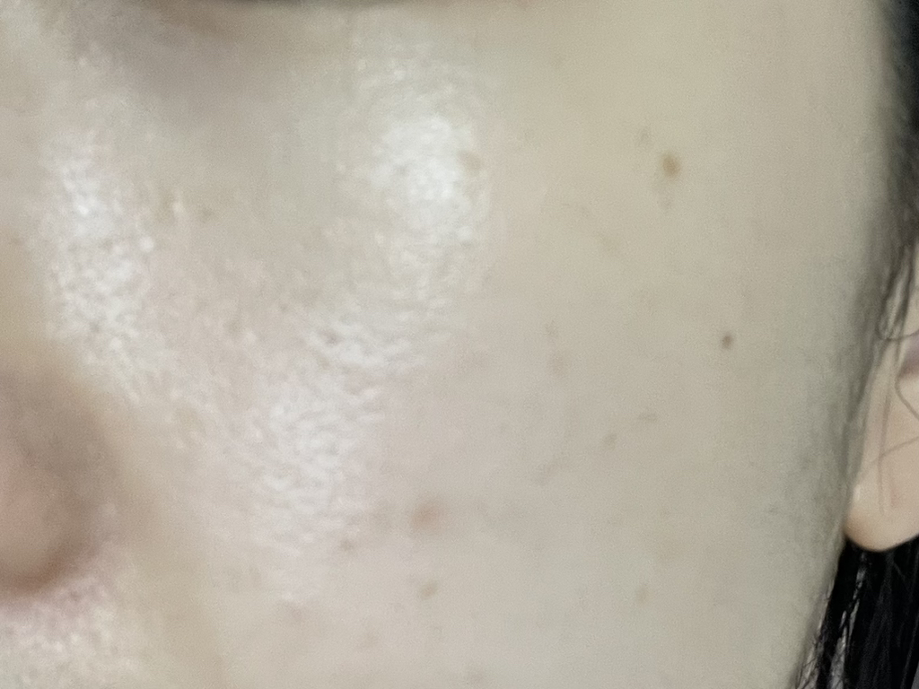 修复疗法润肤霜的真实用户使用照片