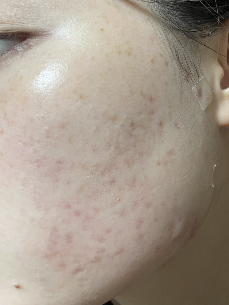 에뛰드 (ETUDE) 더블래스팅 비건 커버 파운데이션 [SPF32/PA++] [21N1 뉴트럴베이지] review image