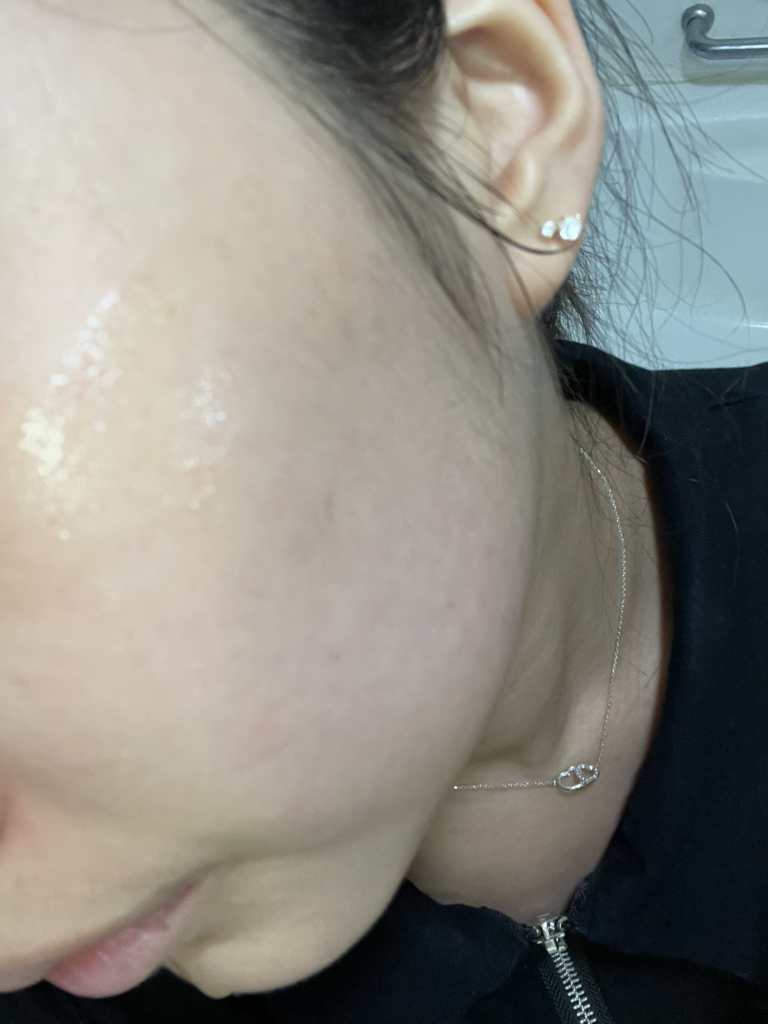 口袋妖怪联名绿色番茄NMN毛孔紧致安瓿的真实用户使用照片