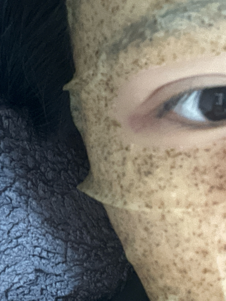 4号SOS紧急镇静冰袋的真实用户使用照片