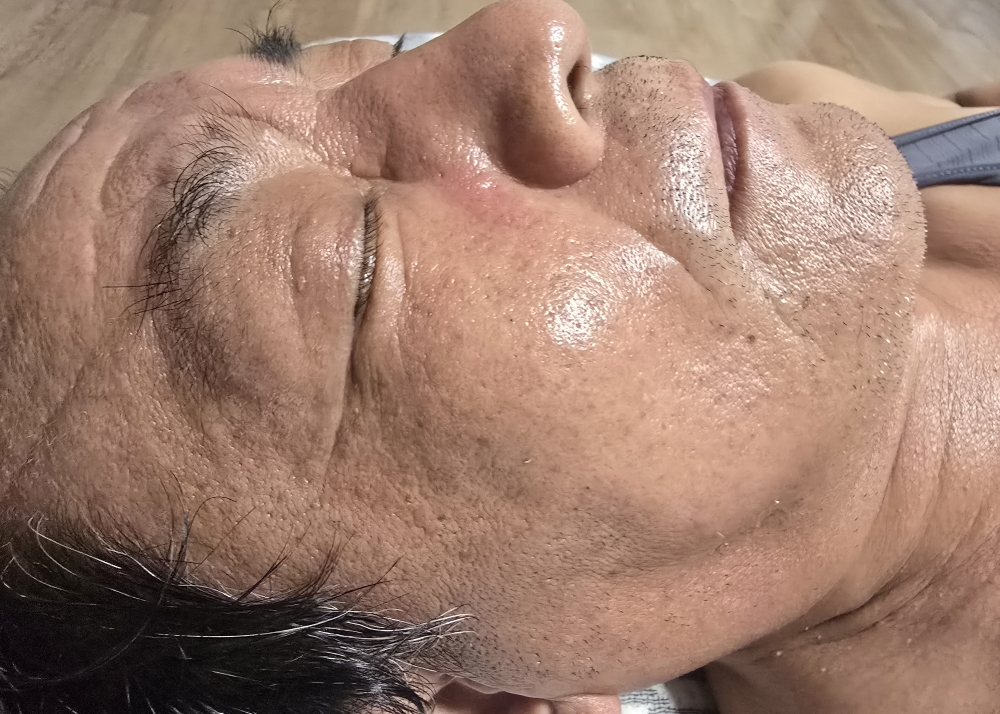 潜入男士低分子玻尿酸全能护理的真实用户使用照片