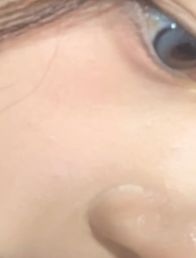 케어존 (CAREZONE) 아큐어 블레미쉬 진정 크림 review image