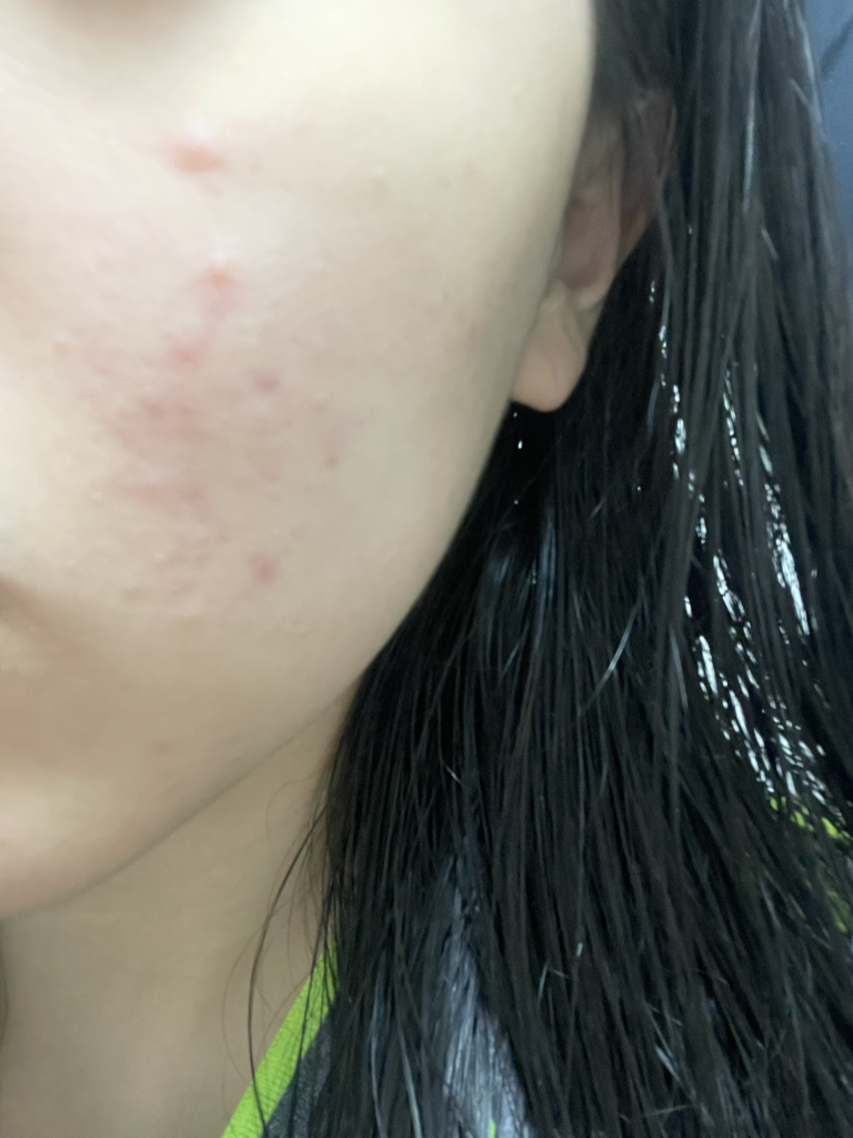 medicube (美蒂秋芙) 红色蔬菜酸垫 common.review image
