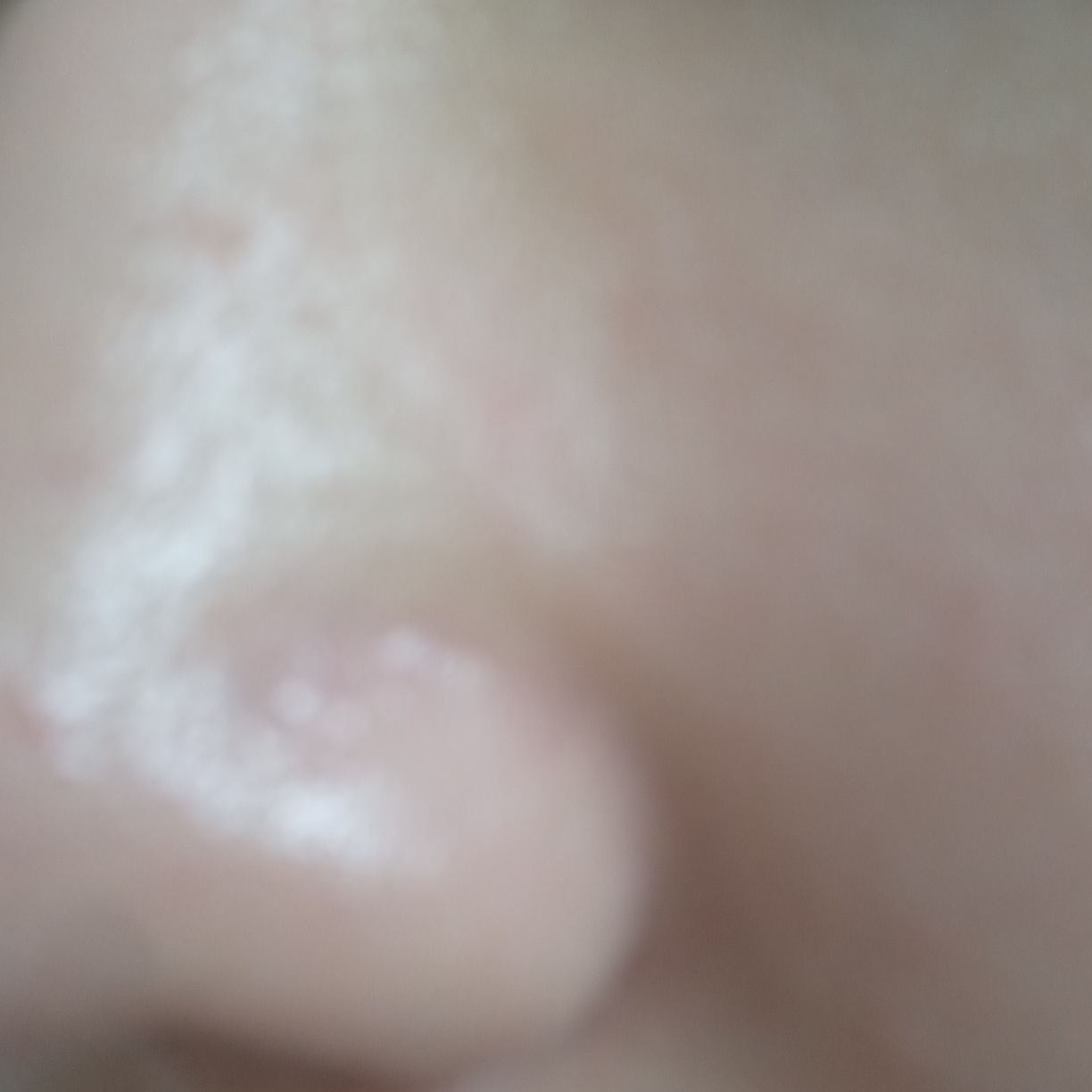 绿豆毛孔去角质水的真实用户使用照片