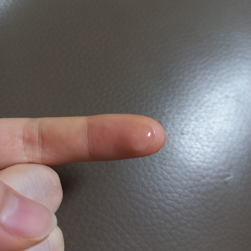 绿豆毛孔去角质水的真实用户使用照片