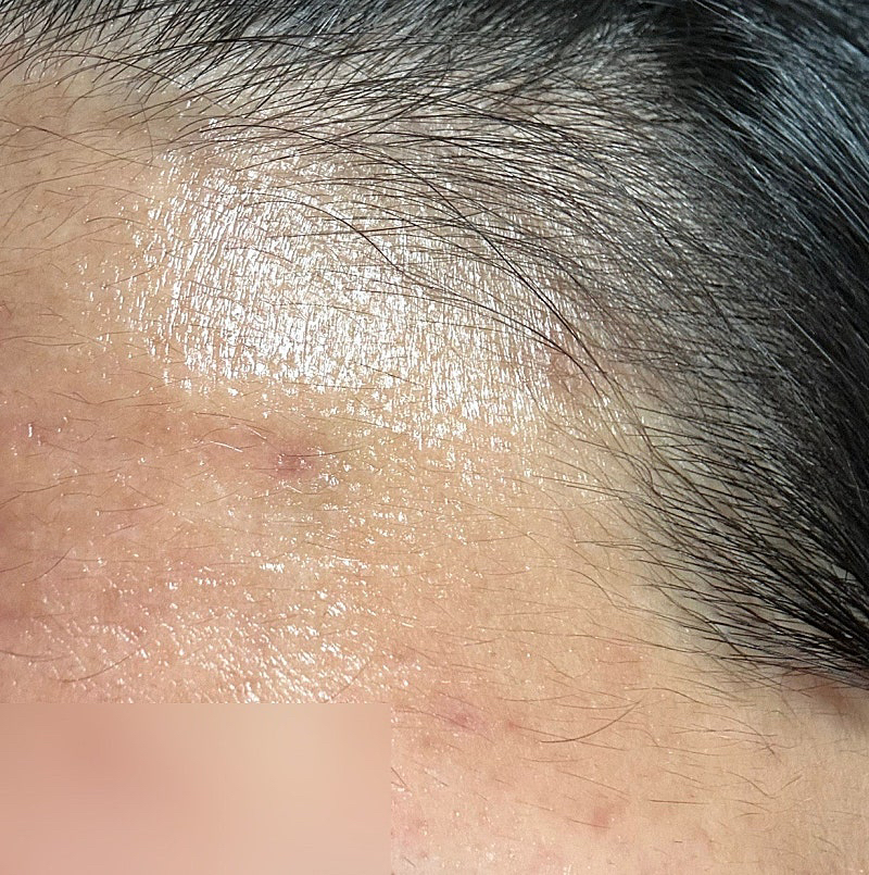 마일드랩 (mildlab) 베타트리칸 앰플 review image