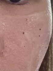 메디필 (MEDIPEEL) 피토 시카놀 B5 카밍 비건 랩핑 마스크 review image