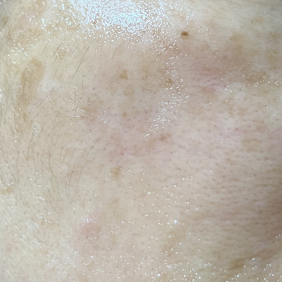 메디테라피 (MEDITHERAPY) 비타 리얼 토닝 레이저 크림 review image