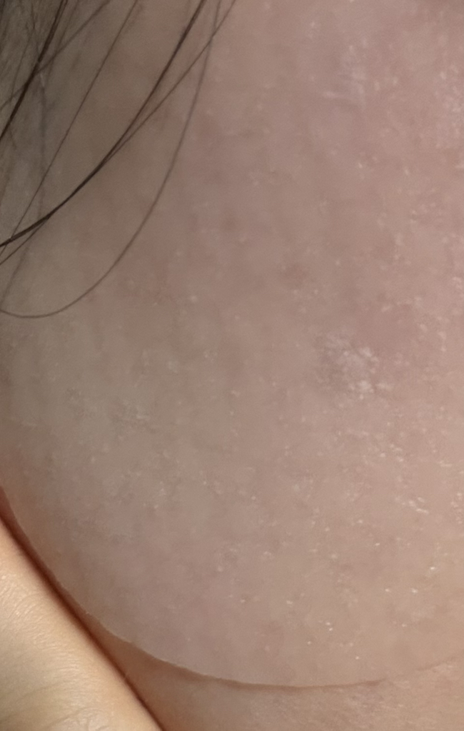 胶原蛋白凝胶垫的真实用户使用照片