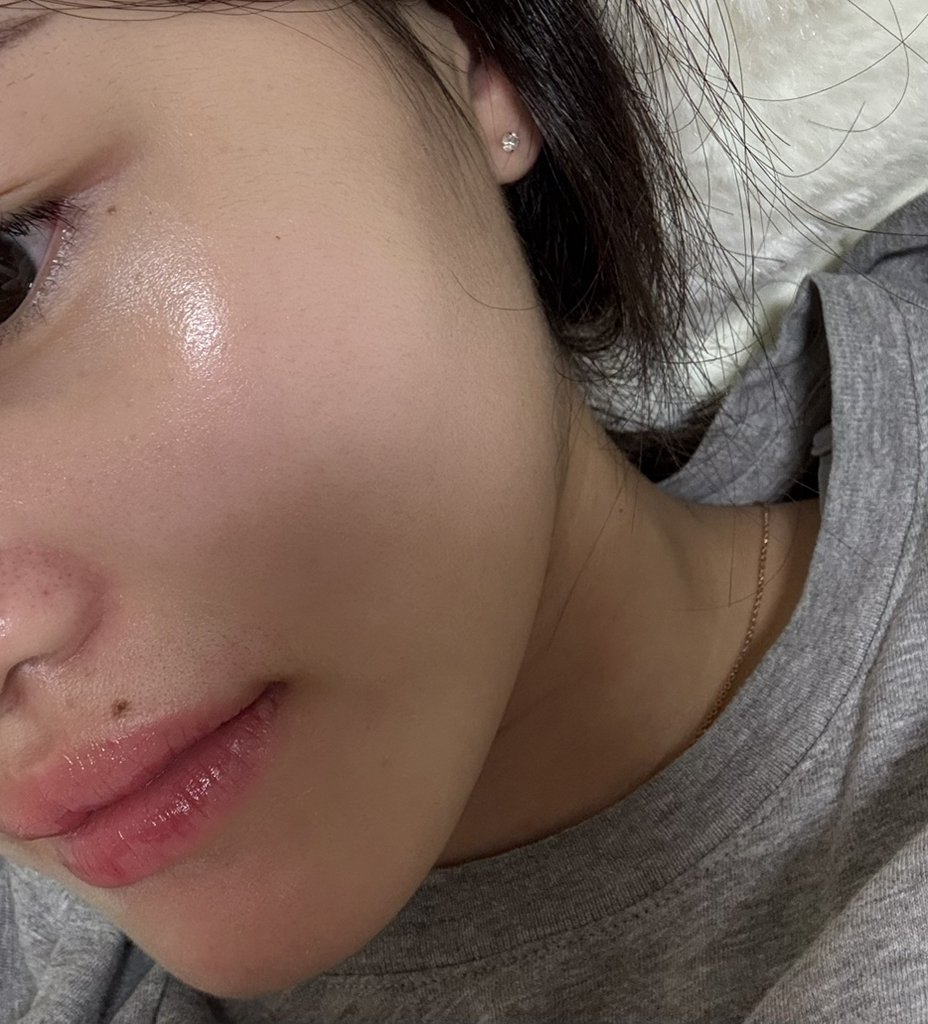 诺丽果活力安瓶精华的真实用户使用照片