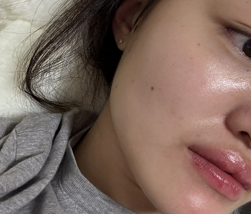 诺丽果活力安瓶精华的真实用户使用照片