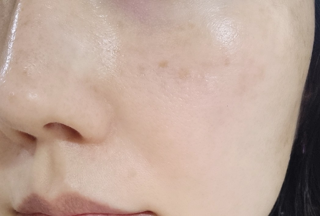 동인비 (DONGINBI) 자생 원액에센스 review image
