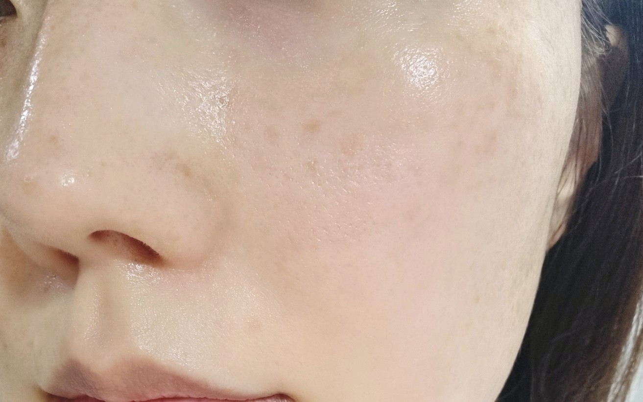 동인비 (DONGINBI) 자생 원액에센스 review image