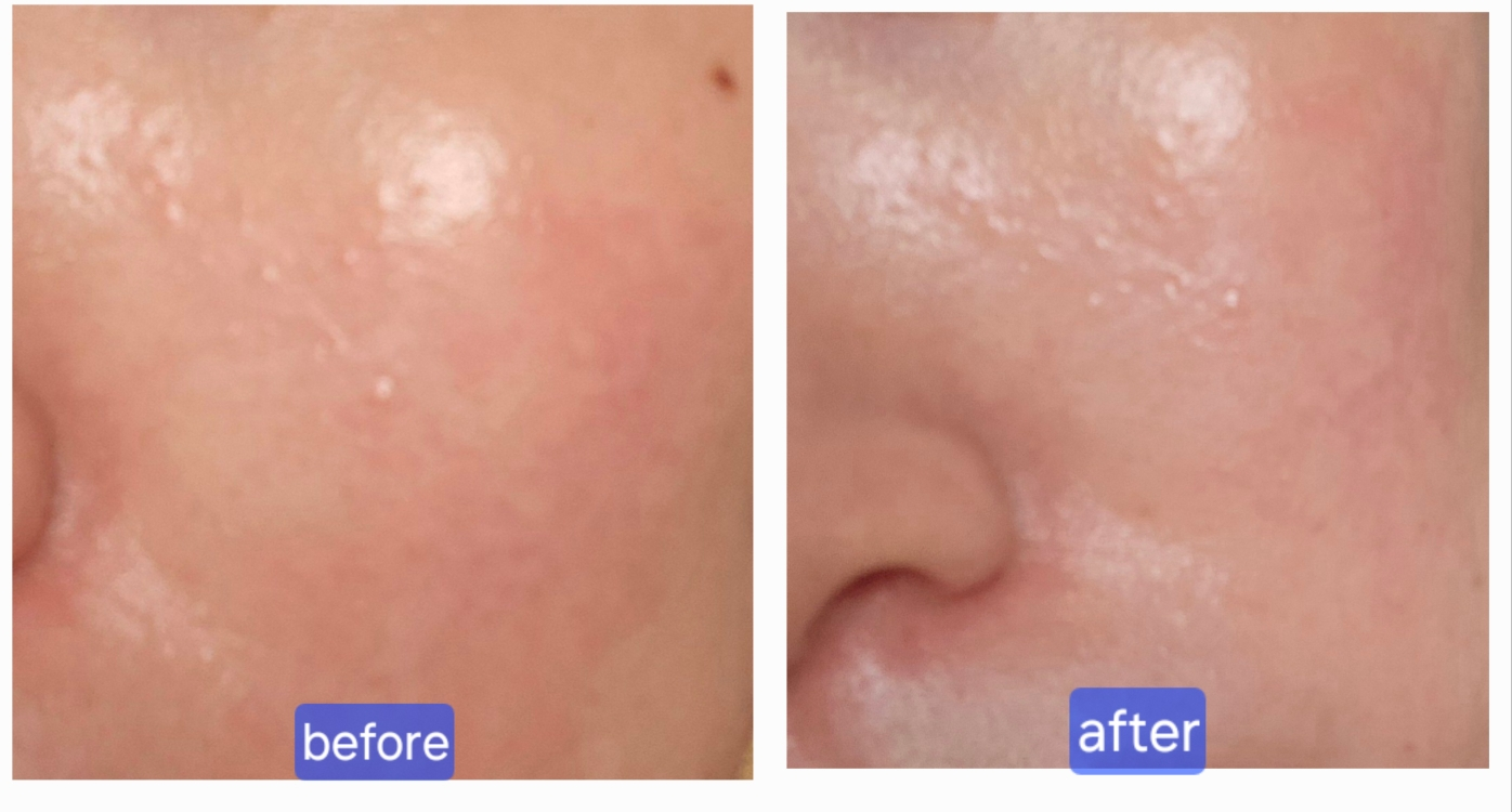 播种 超凡面部低分子量透明质酸精华液 common.review image