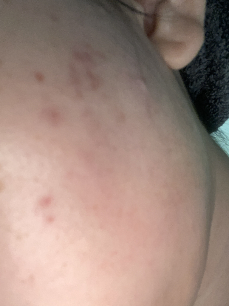 外泌体修复安瓿的真实用户使用照片