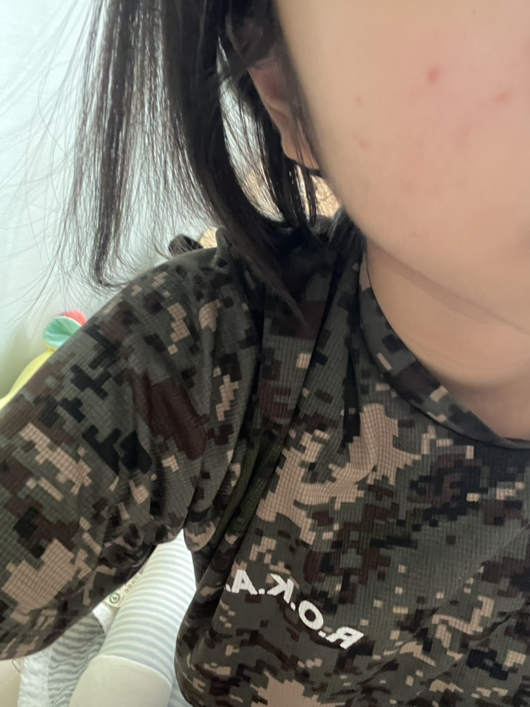 祛痘医生1st控油精华的真实用户使用照片