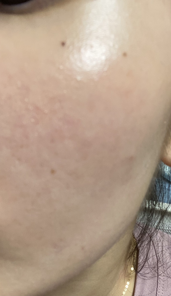 薄荷清洁泡沫的真实用户使用照片