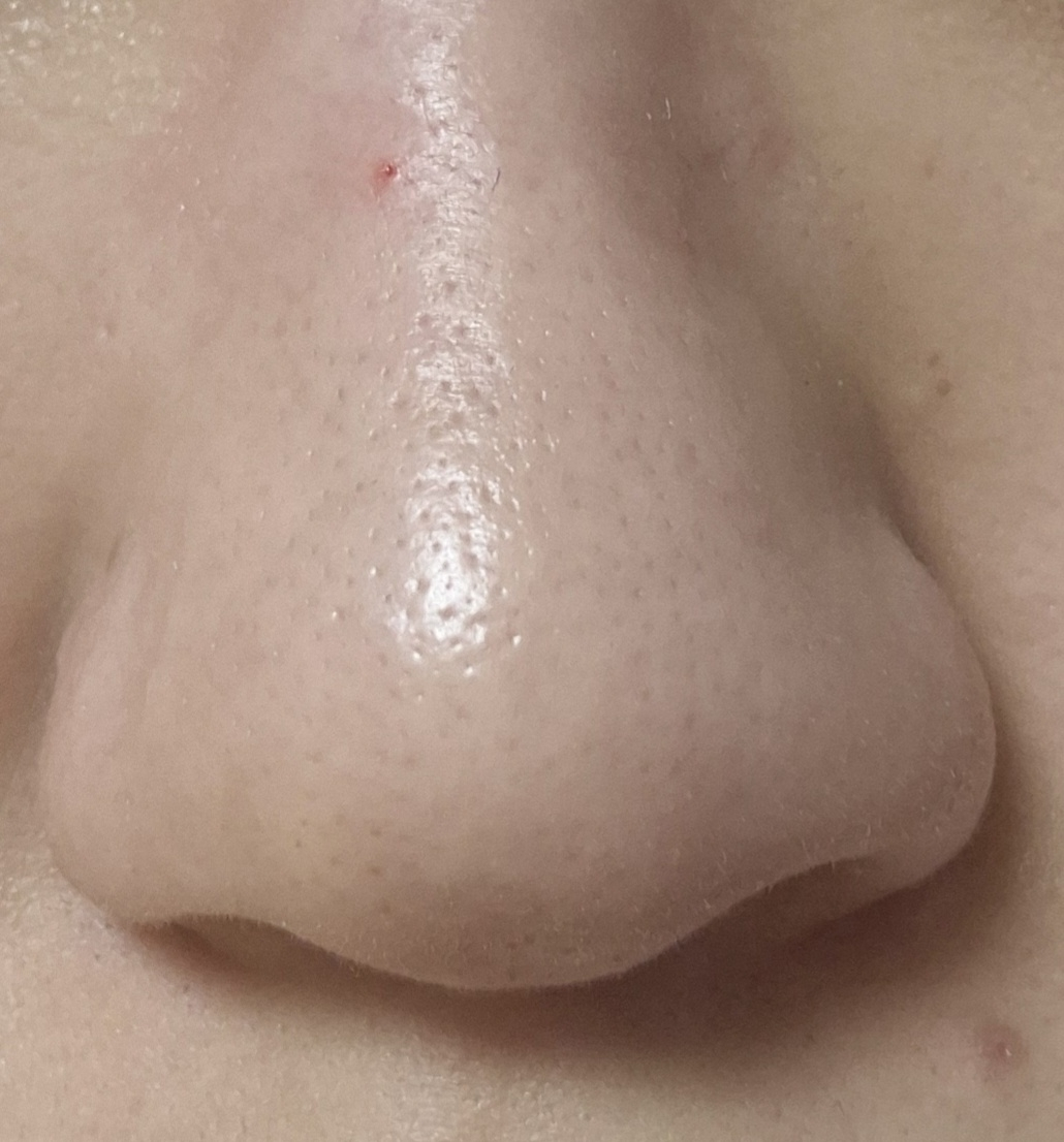 록키스 (Rokkiss) 타이트닝 포어 클린 팩 review image