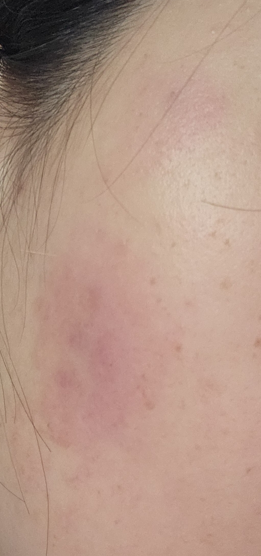水润舒缓霜的真实用户使用照片