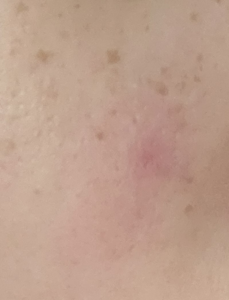 水润舒缓霜的真实用户使用照片