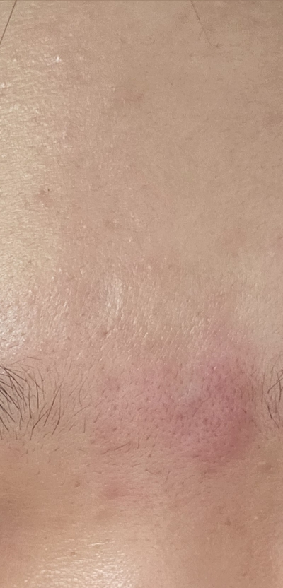 水润舒缓霜的真实用户使用照片