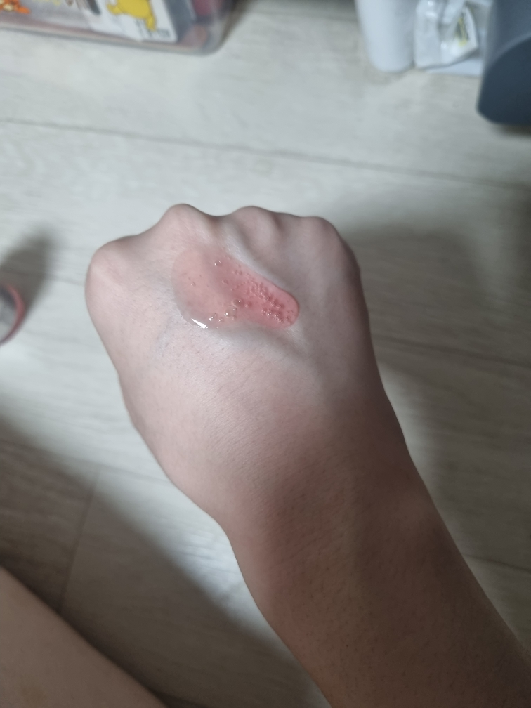 烟酰胺 10 TXA 4 暗斑修复精华的真实用户使用照片