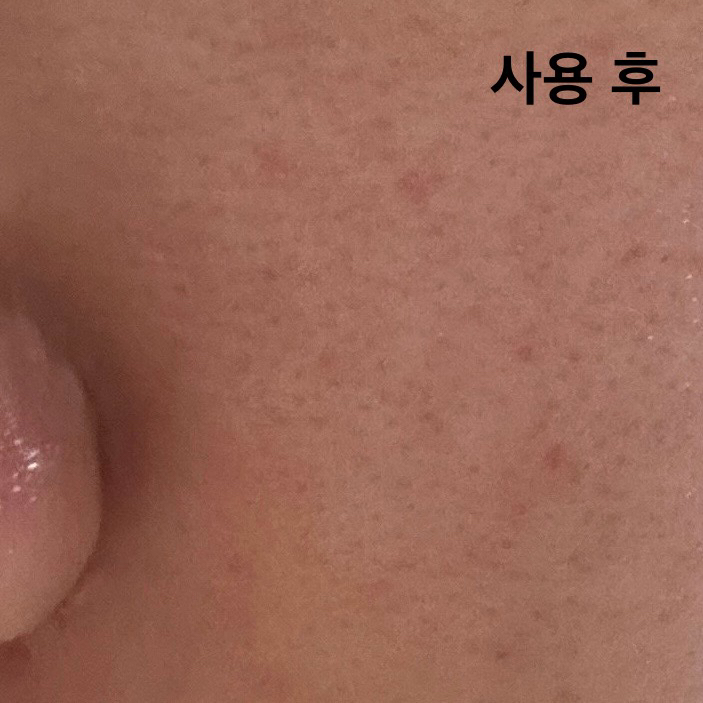 르메이엘 (LeMeill) 쿨링 앤 카밍 아이싱랩 review image