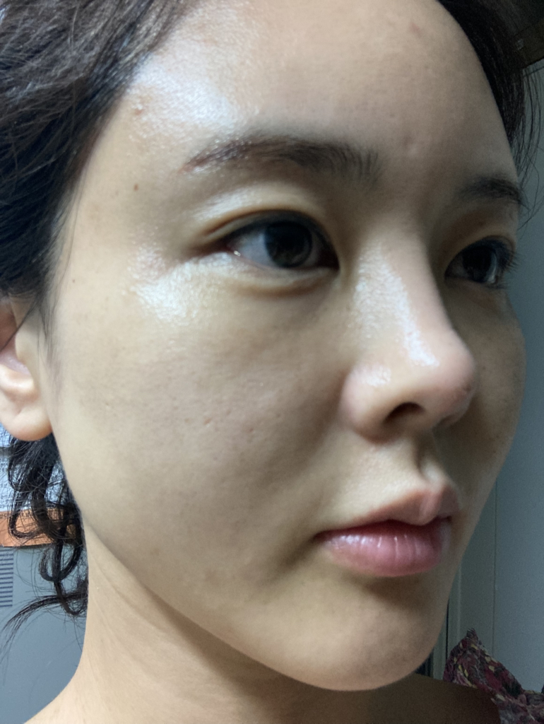 NATUREREPUBLIC 维他命C美斑精华 common.review image