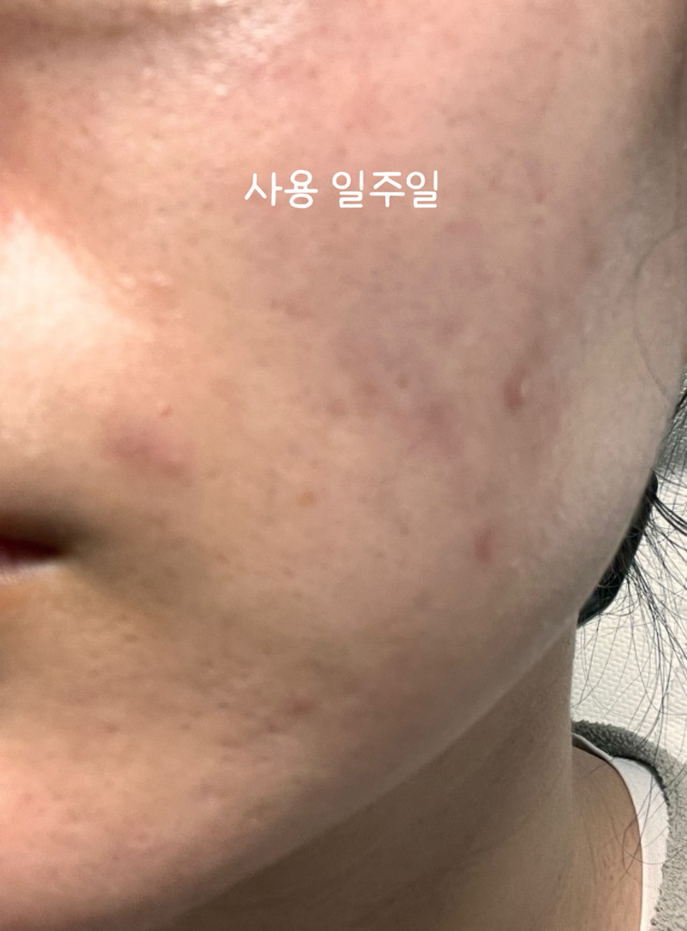에센허브 (essenHERB) 티트리 리페어 솔루션 크림 review image