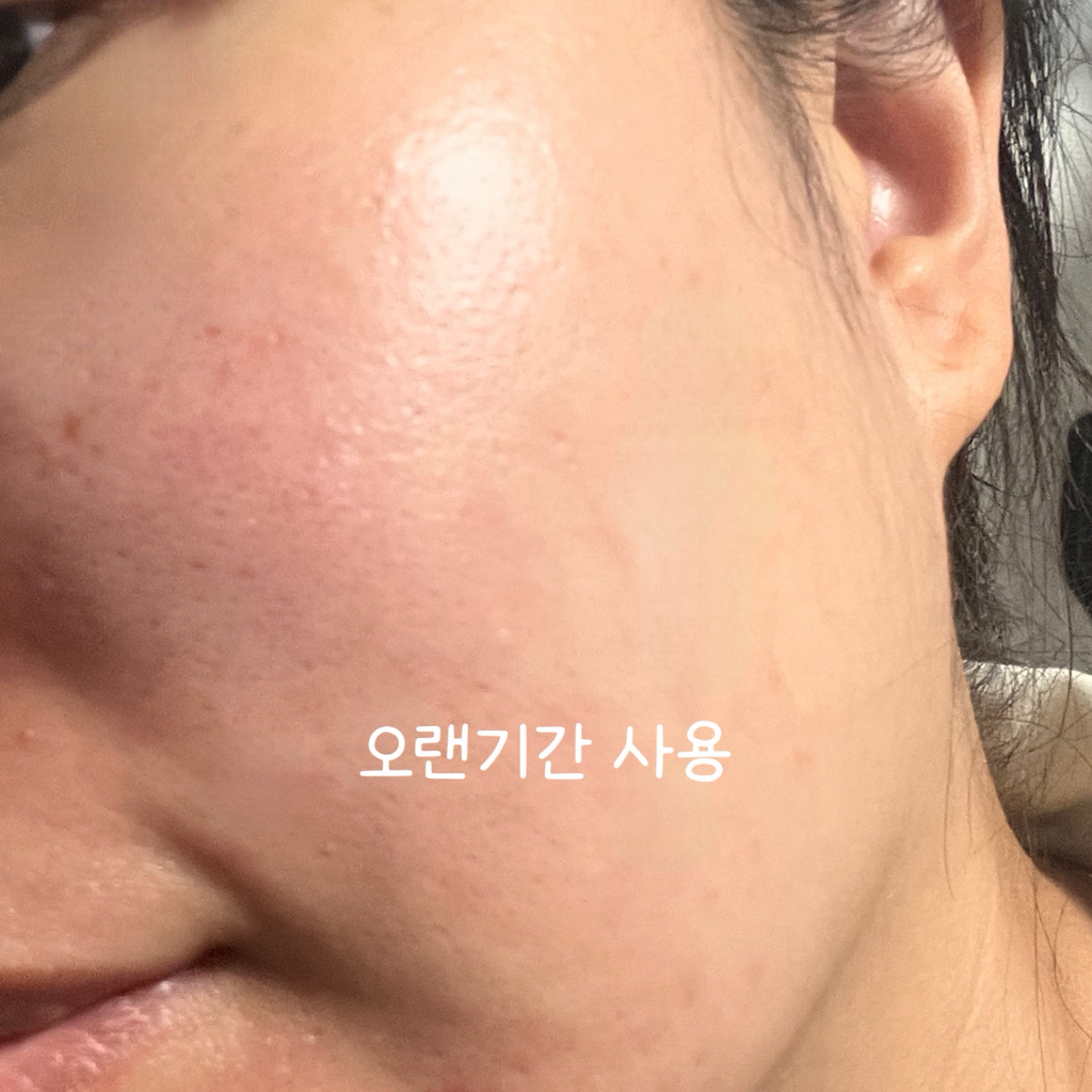 에센허브 (essenHERB) 티트리 리페어 솔루션 크림 review image